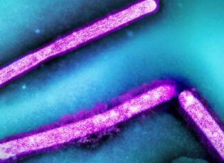 Assessment: CDC Raises Concerns About Bird Flu Pandemic Risk news-10082024-103810