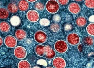 Is the Measles Outbreak in Africa a Global Health Emergency? – WHO Seeks Expert Input news-13082024-163717