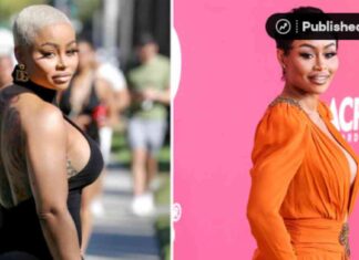 Removing Fillers and Implants: Insights from Plastic Surgeons news-15082024-074653