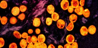 Sweden Reports First Case of MPOX Outside of Africa: What You Need to Know news-15082024-202534