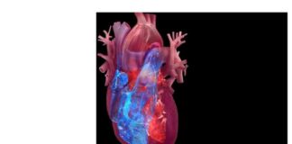 Studying Rare Congenital Heart Defects: $13M Project Focuses on Biological Mechanisms news-16082024-082921