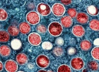 Understanding MPV and Parvovirus: Key Information and Facts news-16082024-143203