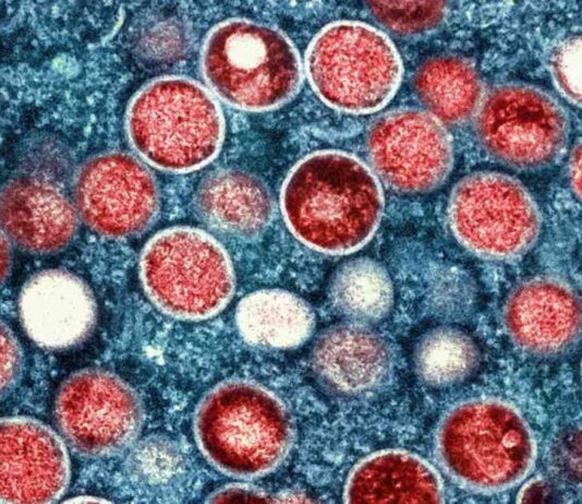 Understanding MPV and Parvovirus: Key Information and Facts news-16082024-143203