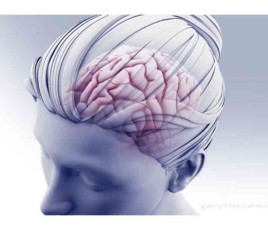 Nurses’ Role in Addressing Mental Well-Being After Stroke news-19082024-131833