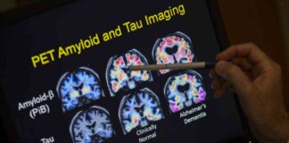 Alzheimer’s Drug Linked to Increased Brain Bleed Risk in Down Syndrome Patients news-22082024-072017