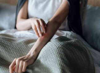 Is MPOX the Next COVID-19? Expert Analysis on Pandemic Potential news-25082024-231208