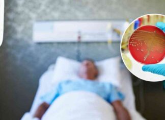 Understanding Sepsis: Prevention and Facts in the US news-04092024-120858