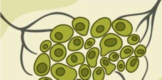 Understanding Metastatic Cancer: Causes, Symptoms, and Treatment Options news-05092024-120944