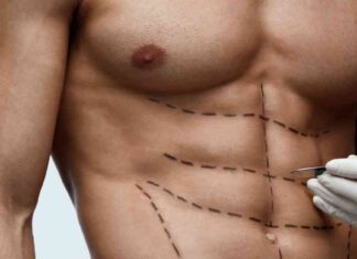 ‘Six-Pack Surgery Trend: Plastic Surgeons Report Increase in Men Seeking Muscle Enhancement’ news-10092024-040407