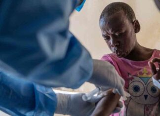 Beginning of Mpox Vaccination Campaign in Congo: What You Need to Know news-10092024-091505