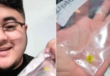 Man Removes Lego from Nose After 30 Years: Finally Able to Breathe news-13092024-031011