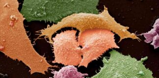 New Title: iTeos and GSK Lung Cancer Drug Shows Promising Response, Highlighting TIGIT as Target news-15092024-030242