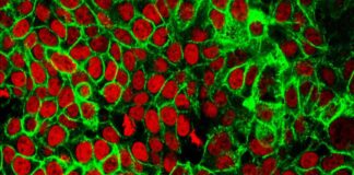 Positive Initial Results in Colon Cancer Blood Test: Exact Sciences Update news-16092024-112845