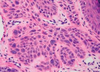 Starving Cancer Cells: Scientists’ Approach to Treating Cancer news-22092024-045828