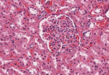 FDA Approves First Drug for Rare Neuron Disease Niemann-Pick Type C news-22092024-090231