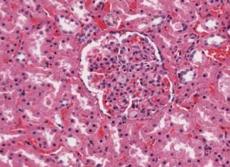 FDA Approves First Drug for Rare Neuron Disease Niemann-Pick Type C news-22092024-090231