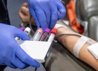 Iron Deficiency in U.S. Adults: Study Reveals 1 in 3 Affected news-25092024-170331