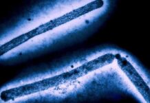 Missouri Bird Flu Case: Testing Delay Raises Questions news-03102024-003443