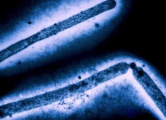 Missouri Bird Flu Case: Testing Delay Raises Questions news-03102024-003443