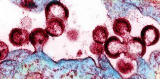 Expanding Access to HIV Prevention Drug: ViiV Faces Criticism news-09102024-062212