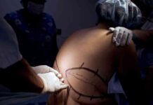 The Impact of GLP-1 Drugs on Bariatric Surgery Demand news-26102024-101213