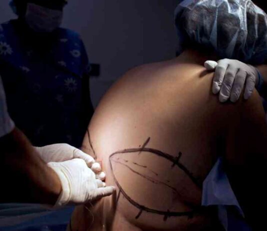 The Impact of GLP-1 Drugs on Bariatric Surgery Demand news-26102024-101213