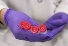 Challenges of Blood-Based Alzheimer’s Biomarkers in Healthcare System news-27102024-222608
