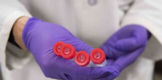 Challenges of Blood-Based Alzheimer’s Biomarkers in Healthcare System news-27102024-222608