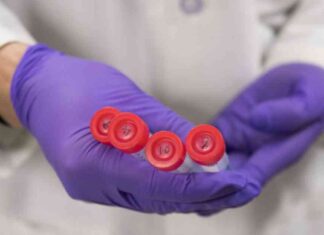 Challenges of Blood-Based Alzheimer’s Biomarkers in Healthcare System news-27102024-222608