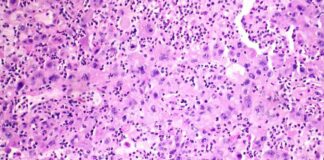 David Epstein launches new cancer startup after Novartis and Seagen career news-28102024-163033