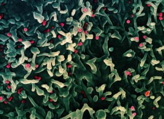 New MPOX Strain Detected in California – First U.S. Case news-17112024-001110