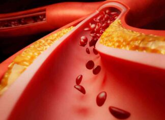 Promising Drugs for Lipoprotein(a) – Reducing Risk of Heart Disease news-19112024-001706