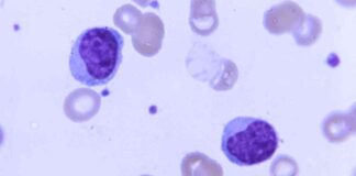 Kura Oncology Licenses Leukemia Drug to Japanese Drugmaker news-21112024-122547