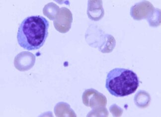 Kura Oncology Licenses Leukemia Drug to Japanese Drugmaker news-21112024-122547