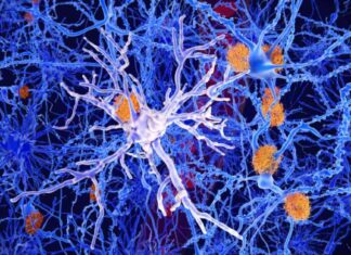 Title: Analysis of Alector Therapeutics’ Alzheimer’s Treatment Failure in Phase 2 Study news-26112024-054957