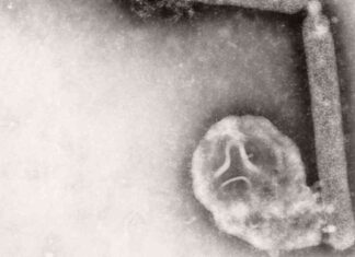 Uncertainty Surrounds Possible Bird Flu Case in California – What You Need to Know uncertainty-surrounds-possible-bird-flu-case-in-california-what-you-need-to-know