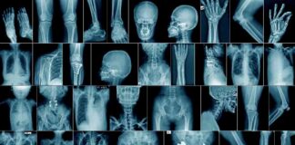 Challenges of AI in Radiology: Grok’s Limitations challenges-of-a-in-radiology-groks-limitations