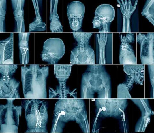 Challenges of AI in Radiology: Grok’s Limitations challenges-of-a-in-radiology-groks-limitations