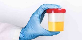 Why is urine yellow? The role of gut health explained why-is-urine-yellow-the-role-of-gut-health-explained