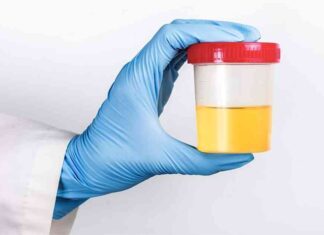 Why is urine yellow? The role of gut health explained why-is-urine-yellow-the-role-of-gut-health-explained