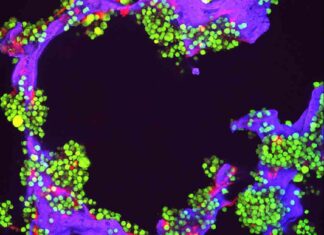 Latest Developments in Multiple Myeloma Research latest-developments-in-multiple-myeloma-research