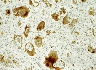 Experiencing Vaccine-Preventable Illnesses: Real Stories and Insights experiencing-vaccine-preventable-llnesses-real-stories-and-nsights