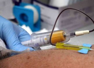 First Blood Test FDA Approved for Alzheimer’s Diagnosis first-blood-test-fda-approved-for-alzheimers-diagnosis