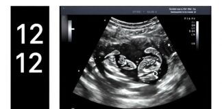 See Your Baby’s Development at the 12-Week Ultrasound