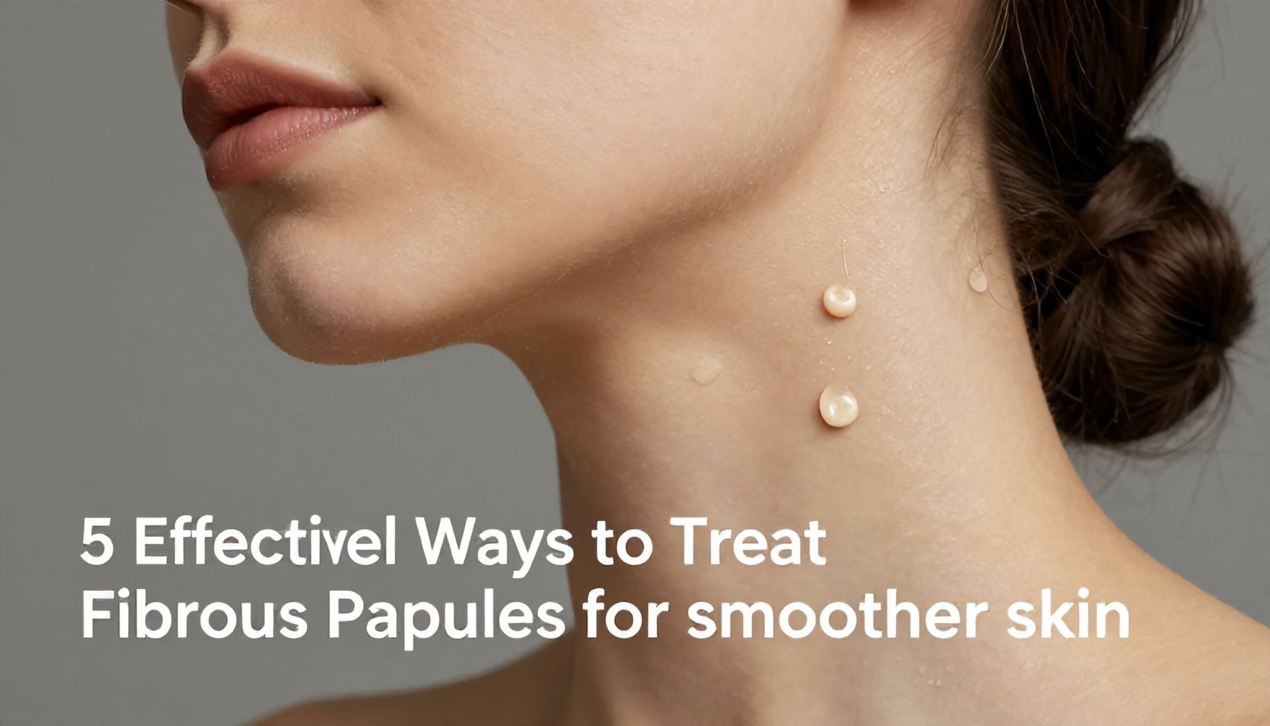 5 Effective Ways to Treat Fibrous Papules for Smoother Skin*