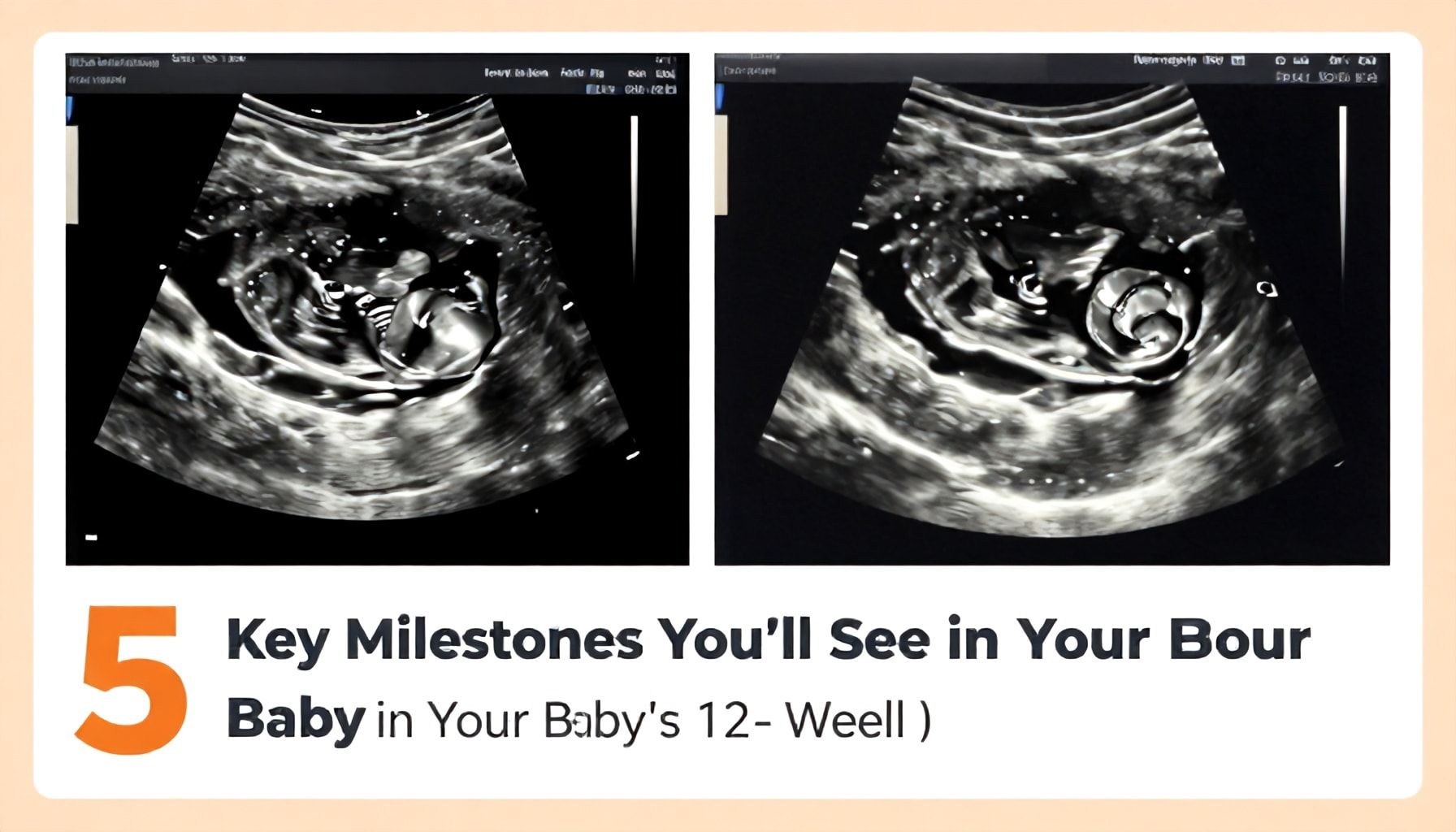 5 Key Milestones You’ll See in Your Baby’s 12-Week Scan*