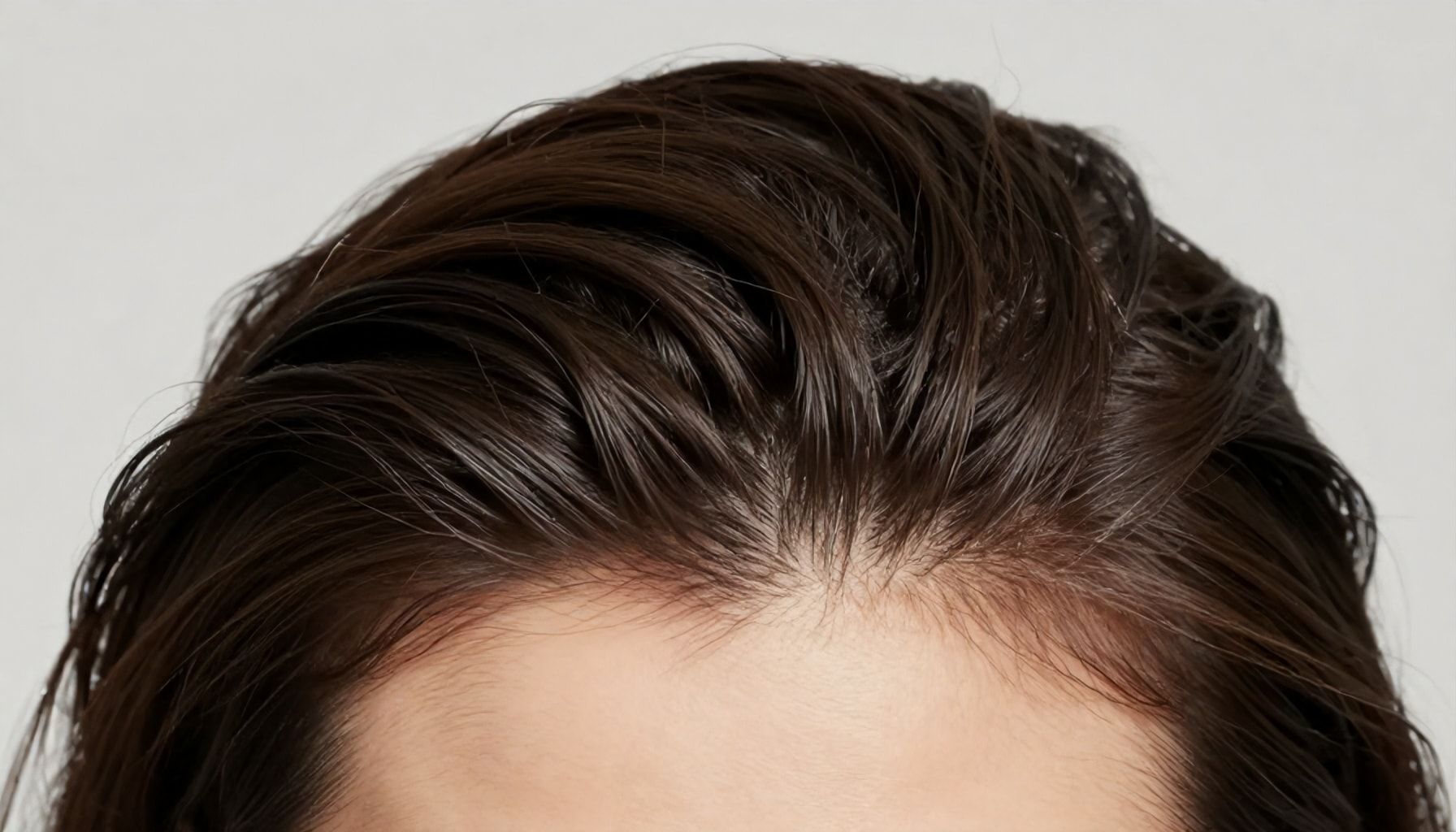 5 Natural Ways to Stop Hair Loss and Regrow Your Hairline"*