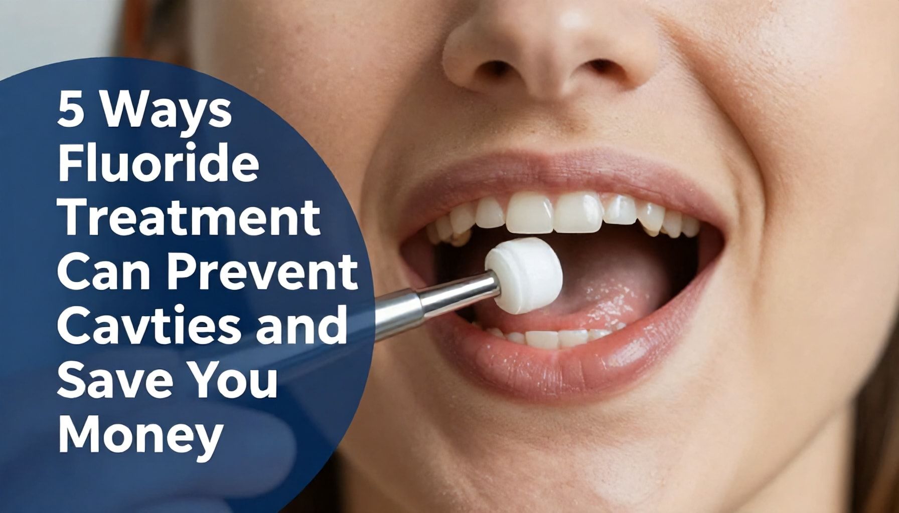 5 Ways Fluoride Treatment Can Prevent Cavities and Save You Money*