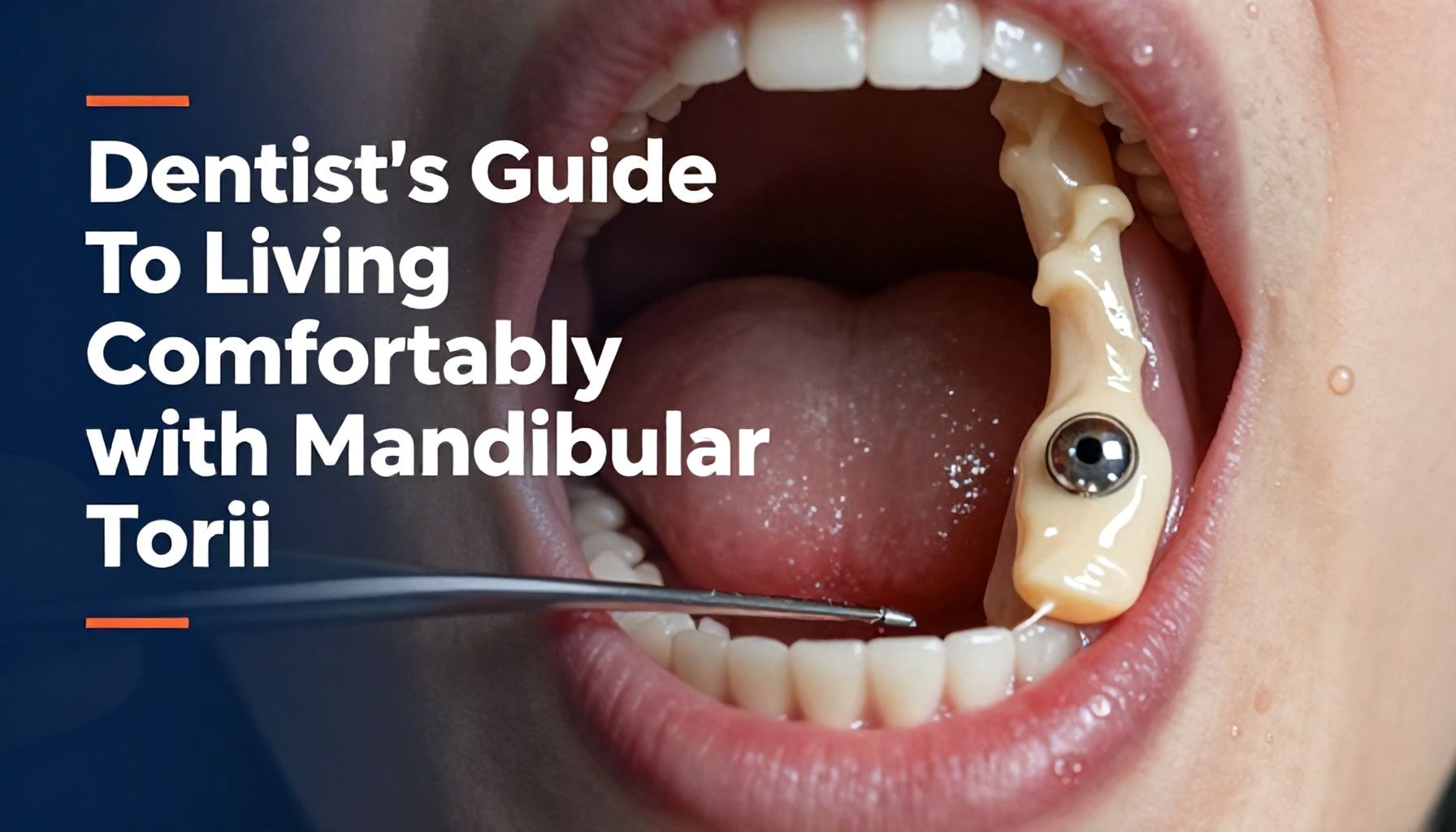 A Dentist’s Guide to Living Comfortably with Mandibular Tori*