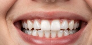 Straighten Your Smile at Any Age with Adult Braces